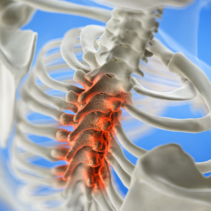 spinal Stenosis treatment in La Verne